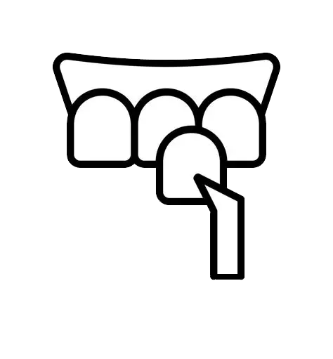 لمینت
